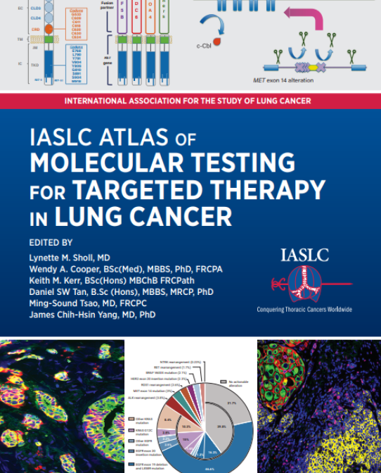 IASLC の肺癌における標的療法のための分子検査のアトラス