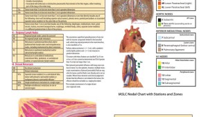 Poster 8th Edition Lung Cancer TNM Staging Summary Poster