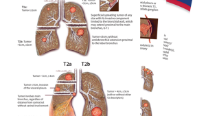 Staging Cards — 9th Edition