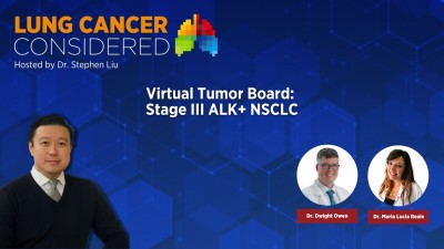 Virtual Tumor Board: Stage III ALK+ NSCLC Virtual Tumor Board: Stage III ALK+ NSCLC