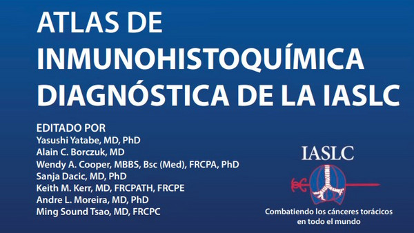 ATLAS DE INMUNOHISTOQUÍMICA DIAGNÓSTICA DE LA IASLC EDITADO POR Yasushi Yatabe, MD, PhD Alain C. Borczuk, MD Wendy A. Cooper, MBBS, Bsc (Med), FRCPA, PhD Sanja Dacic, MD, PhD Keith M. Kerr, MD, FRCPATH, FRCPE Andre L. Moreira, MD, PhD Ming Sound Tsao, MD, FRCPC