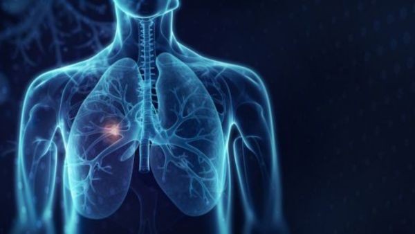 IASLC Staging Project: Lung Cancer, Thymic Tumors, and Mesothelioma
