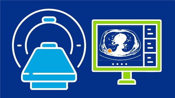 Screening & Early Detection Committee
