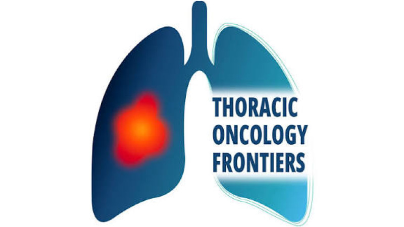 Thoracic Oncology Frontiers