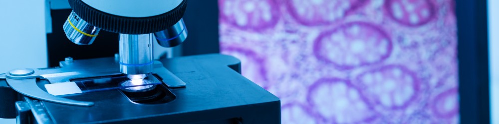 IASLC Atlas of Molecular Testing for Targeted Therapy in Lung Cancer IASLC Atlas of Molecular Testing for Targeted Therapy in Lung Cancer