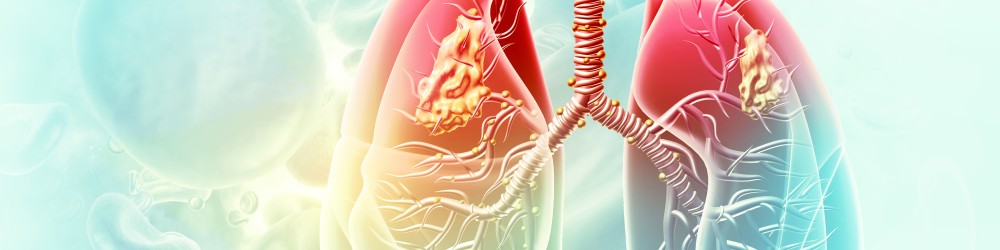 The Early Lung Imaging Confederation Early Lung Imaging Confederation