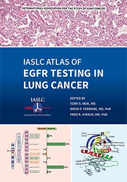 Atlas de testes de EGFR em capa de câncer de pulmão