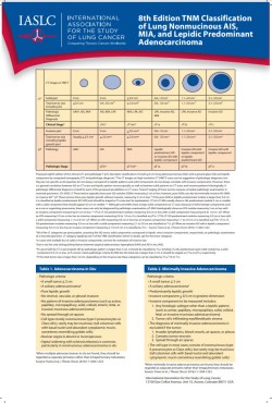 Pôster 8ª Edição Classificação TNM de MIA de AIS pulmonar não mucinoso e Adenocarcinoma Lepídico Predominante Pôster