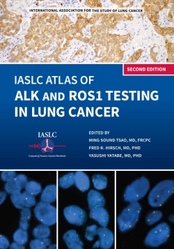O Atlas IASLC de testes de ALK e ROS1 em câncer de pulmão