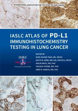 O Atlas IASLC de Teste de PD-L1 em ​​Câncer de Pulmão
