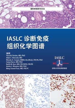 编辑 Yasushi Yatabe, MD, PhD Alain C. Borczuk, MD Wendy A. Cooper, MBBS, Bsc(Med), FRCPA, PhD Sanja Dacic, MD, PhD Keith M. Kerr, MD, FRCPATH, FRCPE Andre L. Moreira, MD, PhD Ming Sound Tsao, MD, FRCPC IASLC 诊断免疫 组织化学图谱 征服全世界的胸部癌症 国际肺癌研究协会