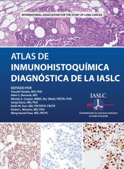 ATLAS DE INMUNOHISTOQUÍMICA DIAGNÓSTICA DE LA IASLC EDITADO POR Yasushi Yatabe, MD, PhD Alain C. Borczuk, MD Wendy A. Cooper, MBBS, Bsc (Med), FRCPA, PhD Sanja Dacic, MD, PhD Keith M. Kerr, MD, FRCPATH, FRCPE Andre L. Moreira, MD, PhD Ming Sound Tsao, MD, FRCPC