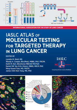 IASLC の肺癌における標的療法のための分子検査のアトラス