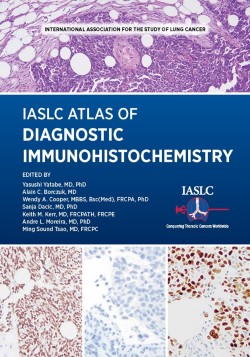 診断用免疫組織化学の IASLC アトラス